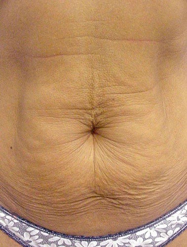 30b